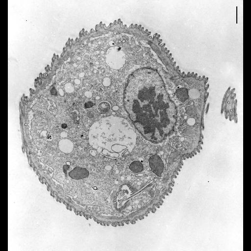  NCBI Organism:Opercularia [NCBITaxon:168247], , ; Cell Types:cell by organism, eukaryotic cell, , ; Cell Components:oral apparatus, macronucleus, cytoplasm, cell cortex; Biological process:cortical cytoskeleton organization, , cytoplasm organization;