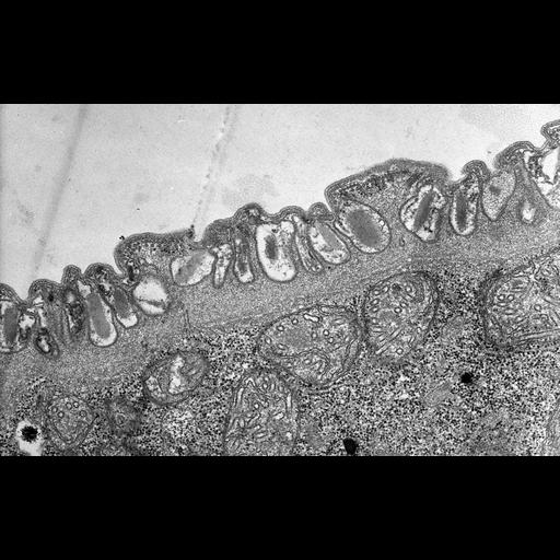  NCBI Organism:Didinium nasutum; Cell Types:cell by organism, eukaryotic cell, , ; Cell Components:cell cortex, cortical microtubule cytoskeleton, ; Biological process:, cortical microtubule organization, ;