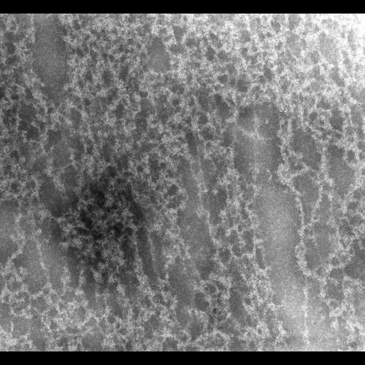  Cell Types:erythrocyte Cell Components:nuclear chromatin Biological process:DNA packaging